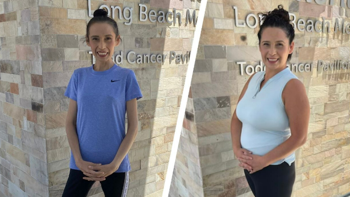 Isabel Orejel Before and After Photo