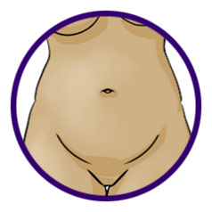 No Noticeable Scars from vNOTES