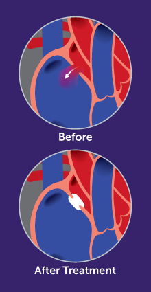 Before & after surgery