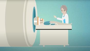 During and After the Focused Ultrasound Treatment video